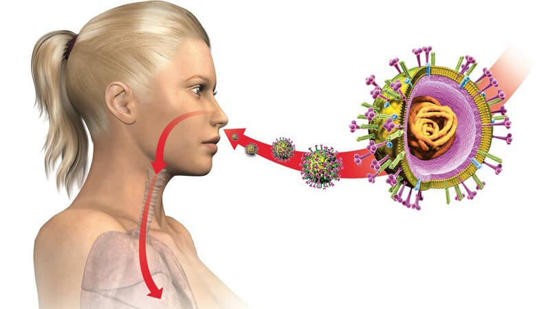 Grafische Darstellung Frau infiziert sich mit Schweinegrippe-Virus