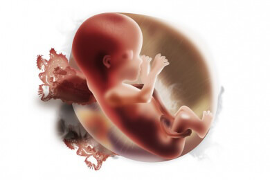 Hirntote gegen ihren Willen am Leben erhalten: Sie soll ihr Baby zur Welt bringen