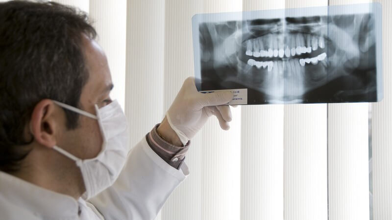Zahnarzt mit Mundschutz hält ein Röntgenbild des menschlichen Kiefers hoch