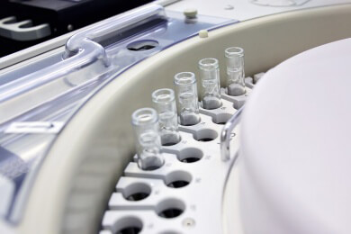 Thrombose oder Nierenschwäche? Der D-Dimer-Wert kann auf beides hindeuten