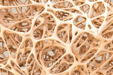 Therapie der Osteoporose: Neuer Antikörper Romosozumab erhöht Knochendichte