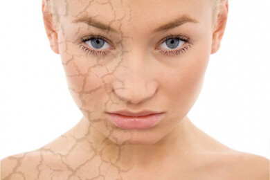 Winterpflege für Körper, Gesicht und Haare - So hilft die Kraft der Natur gegen Trockenheit