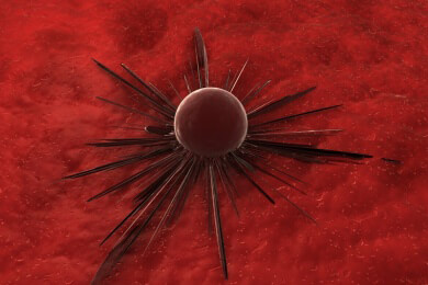 Weltkrebstag: Mediziner räumen mit den vier größten Mythen auf