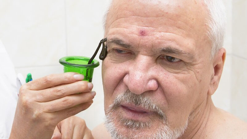 Älterer Mann nimmt mit einem grünen Becher Blutegel von seinem Gesicht runter