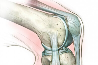 Ob Unfall oder Verschleiß - Meniskusverletzungen sollten immer behandelt werden