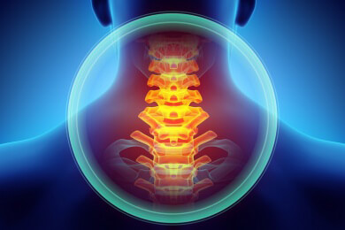 Schleudertrauma - Entstehung, Ausprägungsformen und Behandlung