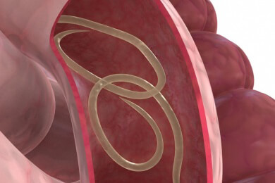 Mehrfacher Parasitenbefall beim Menschen: Langwierige Behandlung notwendig