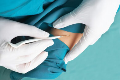 Selbst für schnelllebige Modetrends unters Messer: Markt für Schönheitsoperationen boomt