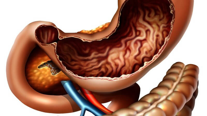 Anatomie - Grafik des menschlichen Magens mit einem Teil des Darms