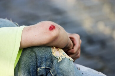 Wundverletzungen beim Kind - Bei größeren Wunden gleich zum Kinderarzt