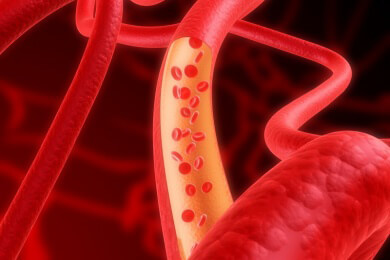 Ursachen, Symptome und Behandlung einer Sepsis
