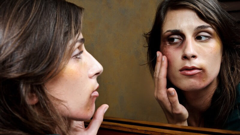 Häusliche Gewalt: junge Frau mit Blutergüssen betrachtet Gesicht im Spiegel