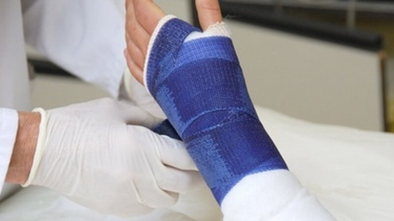 Linker Arm einer Frau mit gebrochenem Handgelenk wird von Arzt verbunden mit blauem Tapeverband, Gips