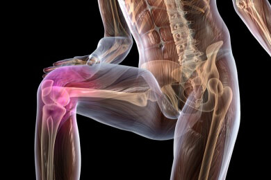 Eine Arthroskopie des Kniegelenks ist oft sinnlos