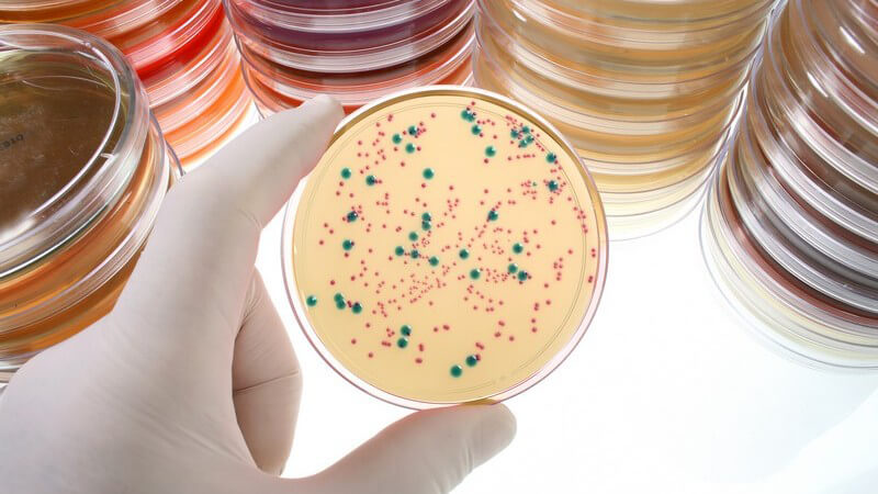 Gestapelte Petrischalen, davor gelbe Petrischale mit grünen und rosanen Bakterienkulturen