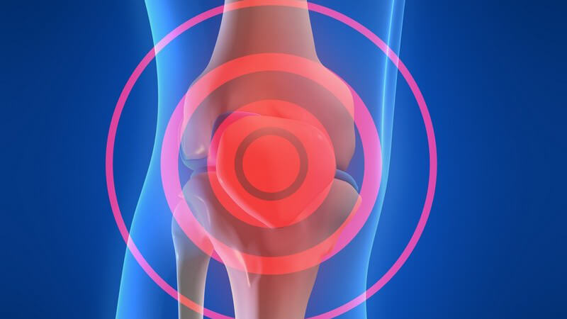 3D Grafik Kniegelenk, Knieschmerzen rot gekennzeichnet, Bein durchsichtig