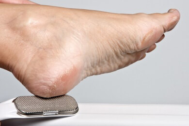 Tipps und Hilfsmittel zur Entfernung von Hühneraugen