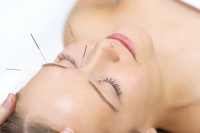 Gute Erfolge der Akupunktur bei Heuschnupfen und Tinnitus