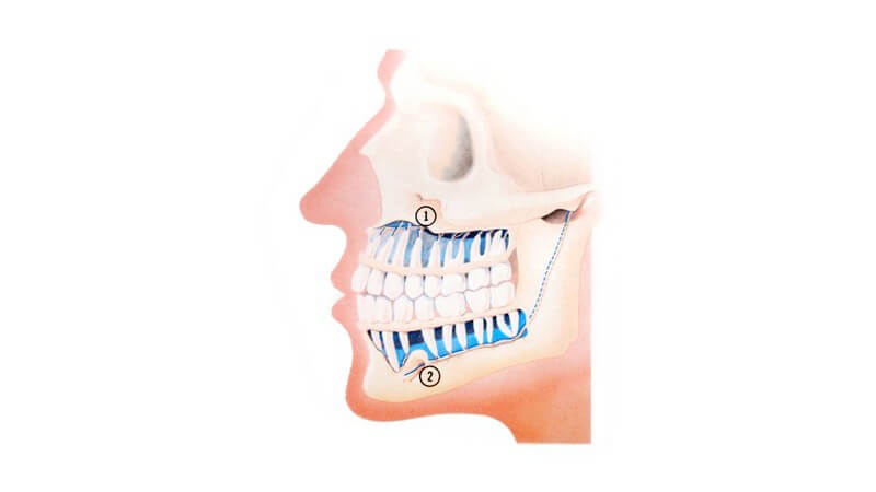 Grafik Seitenansicht menschlicher Kopf mit Zähnen, Kiefer