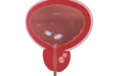 Neue Hilfe bei der Früherkennung: Hunde erschnuppern Prostatakrebs