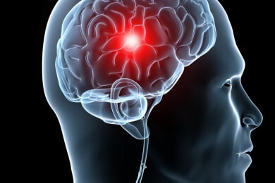 Schlaganfalltherapie: Ein Mikrowellen-Helm erkennt Blutungen in Sekunden