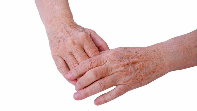 Zwei Hände eines Senioren, Altersflecken