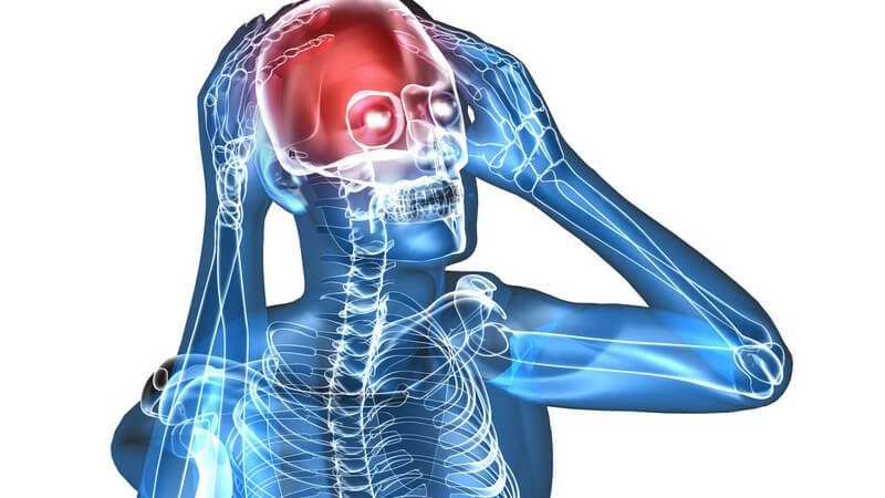 Grafik Körper, Skelett hält sich rot markierten Kopf, Kopfschmerzen