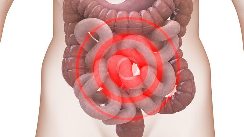 Anatomie - Hellbraune Grafik des menschlichen Darms mit rotem Fadenkreuz