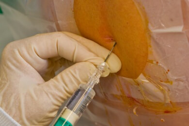 Nach der Narkose - Forscher entdecken, welches Hirnareal das Aufwachen steuert