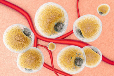 Der ewige Kampf gegen Übergewicht: Braunes Fettgewebe soll helfen