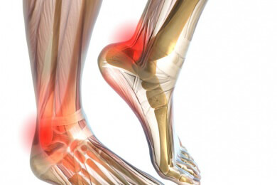 Moderater Sport hilft bei Arthrose - Bewegung wirkt Gelenkverschleiß entgegen