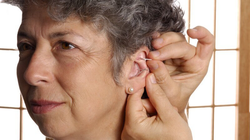 Ältere Frau mit kurzen, grauen Haaren und Perlenohrring erhält eine Akupunktur in die Ohrmuschel