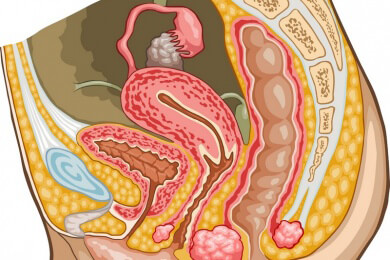 Trockene Scheide - Ursachen finden und verantwortungsbewusst handeln