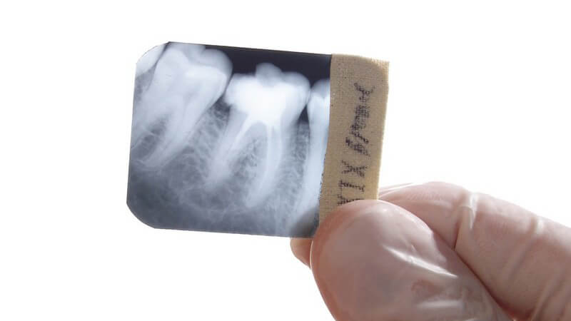 Rechte Hand in Schutzhandschuh hält kleines Röntgenbild von Zähnen und Kiefer, Zahnarzt, weißer Hintergrund