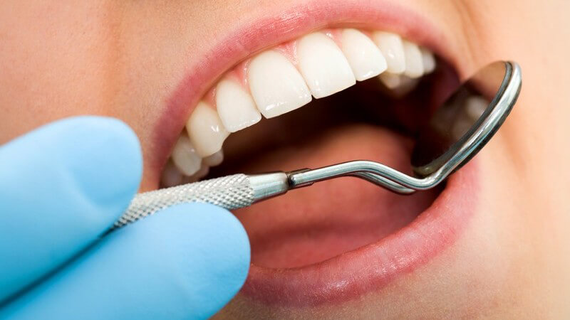 Offener Frauenmund bei Zahnarztuntersuchung