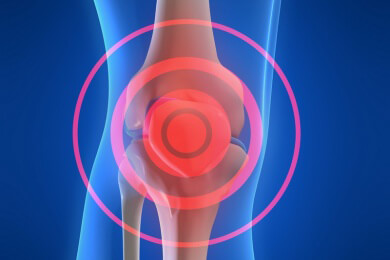Sanfter Sport bei Arthrose - Bewegung ja, Belastung nein