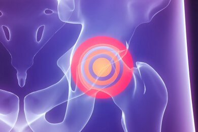 Künstliche Gelenke - neuartige Implantate oft schlechter als alte Modelle