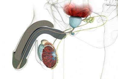 Hodenkrebs: Ärzte fordern Früherkennung als Kassenleistung