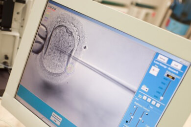 Ungewollt kinderlos - oft liegt es am Mann