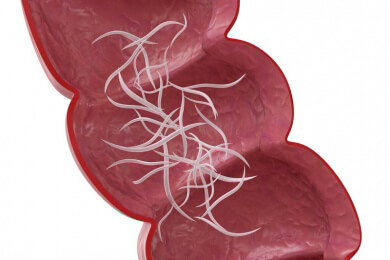 Hakenwürmer als Therapie bei Zöliakie - Symptome der Glutenunverträglichkeit bessern sich