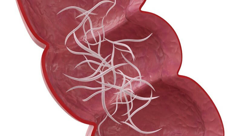 Grafik 3D ausgewachsene Madenwürmer im Darm