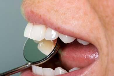 Die alten Römer hatten bessere Zähne als der moderne Mensch - Parodontitis damals fast unbekannt