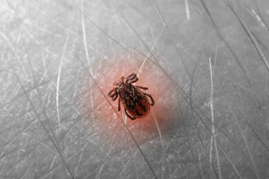 Kinder mit Hüftschmerz ohne erkennbare Ursache - eine Borreliose könnte Schuld sein