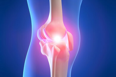 Gonarthrose durch effektive Diät bekämpfen?