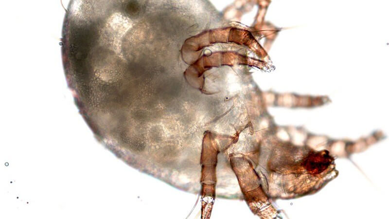 Mikroskopisches Bild einer Staubmilbe