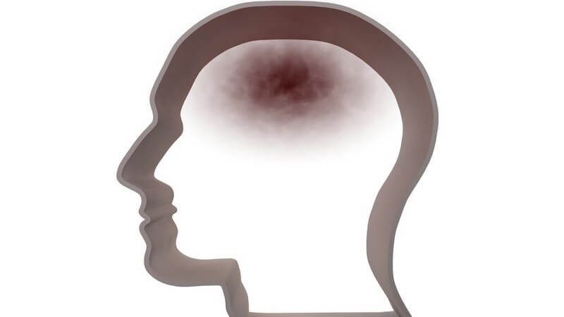 Grafik menschlicher Kopf mit dunkler Verfärbung - Kopfschmerzen