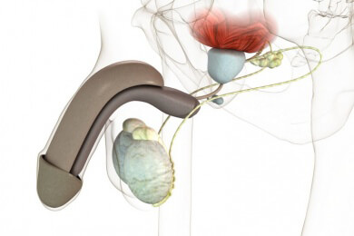 Mehr Aufklärung gefordert: Prostatabiopsien können zu Erektionsproblemen führen