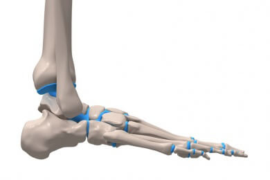 Bei rheumatoider Arthritis die Füße und das Fußgelenk nicht vergessen