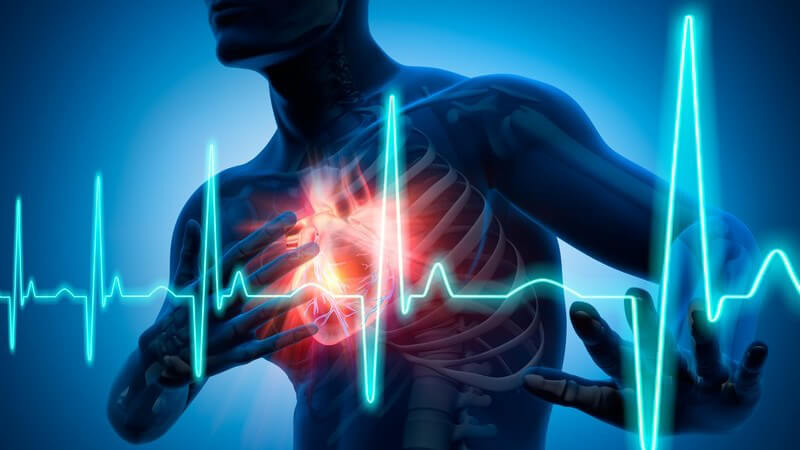 Grafik Mensch mit Herzschmerzen - Herzinfarkt