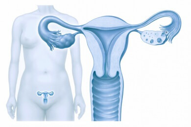Risiko auf Eierstockkrebs steigt unter einer Hormonersatztherapie